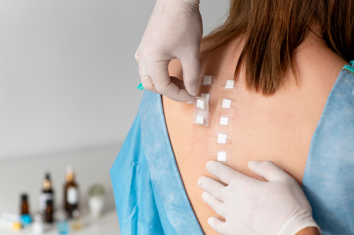 A clinical professional wearing white gloves carefully removes adhesive patch test units from a participant's back to evaluate the skin for irritation.